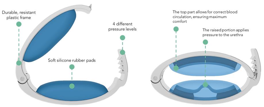 How does Wiesner Incontinence Clamp work?